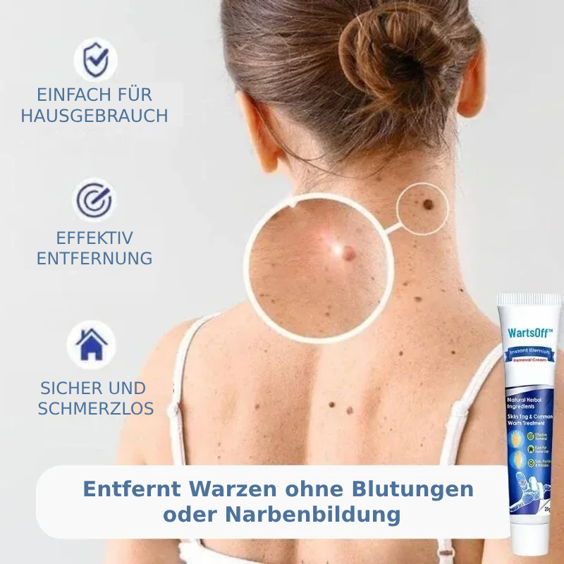 WartsOff™ Entfernt Warzen im Handumdrehen