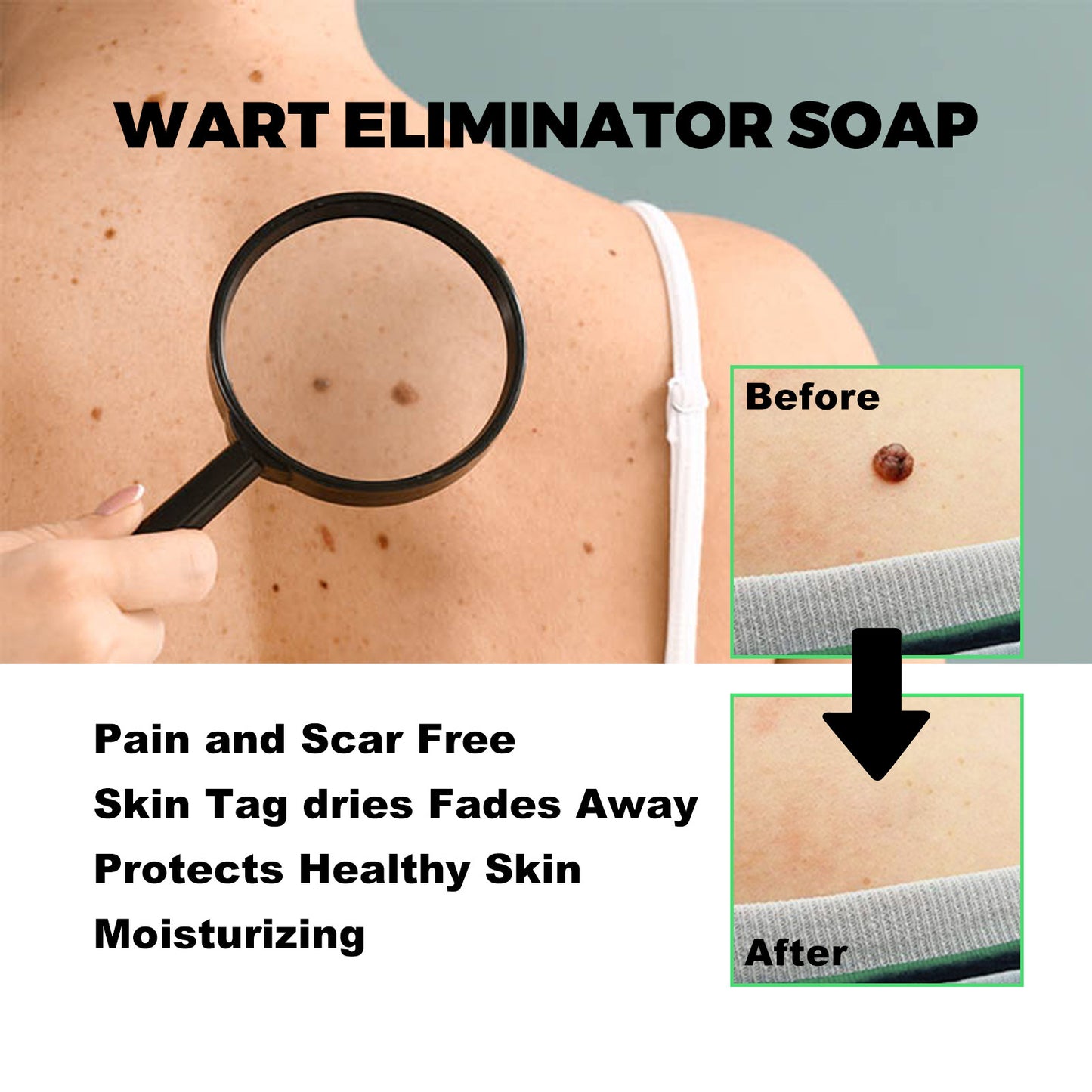 WartSoap™ | Wart removal | GE