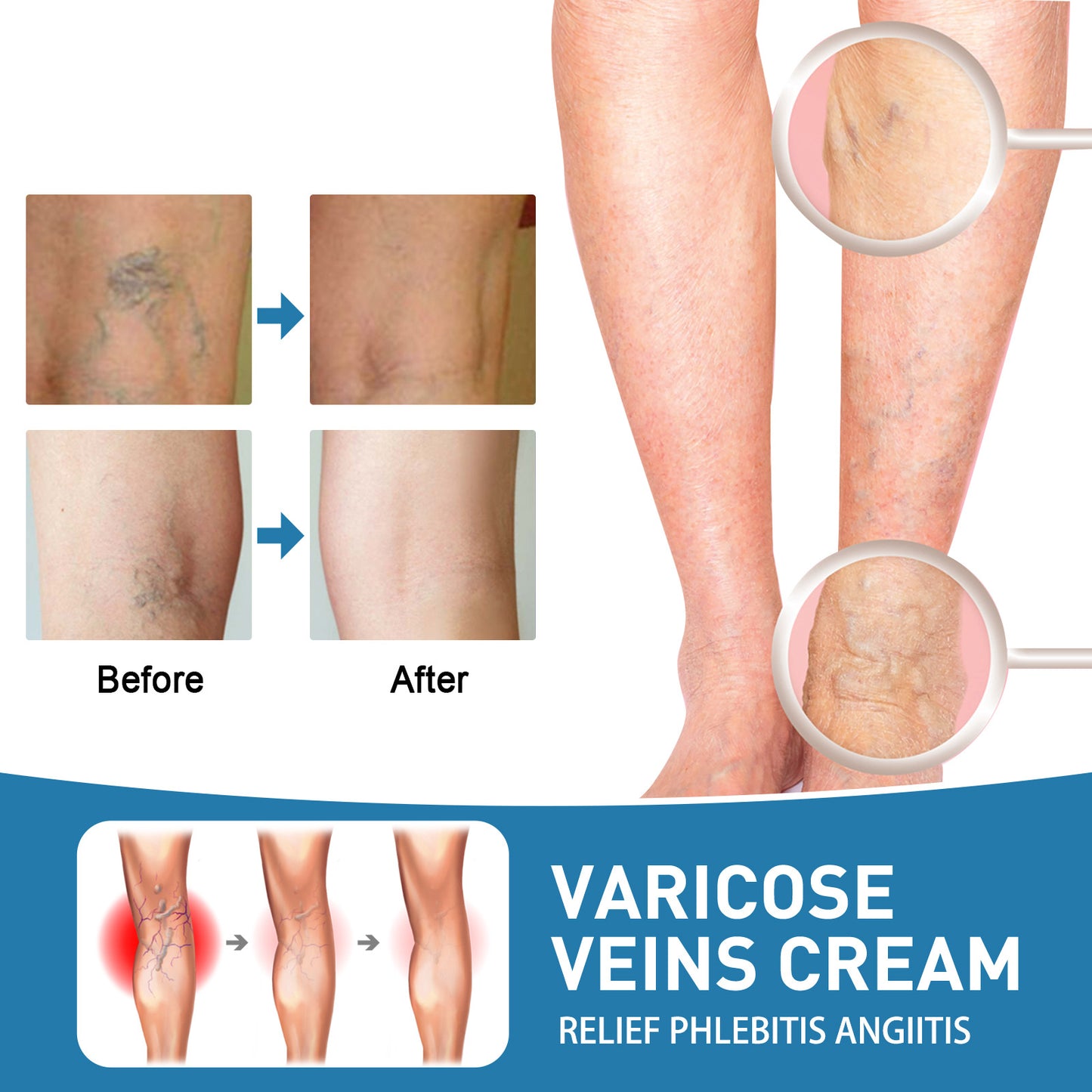 VitalVenen | Vein Repair Cream Massage