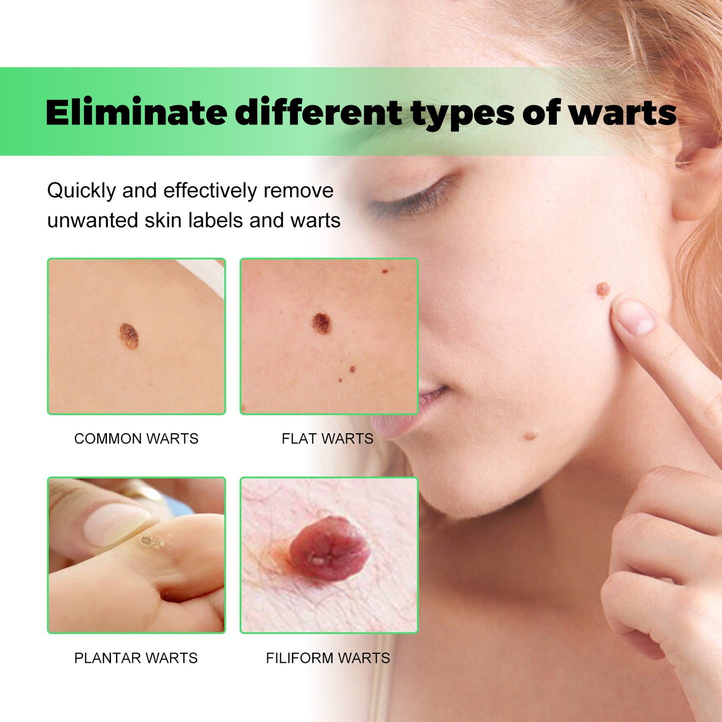 WartSoap™ | Wart removal | GE