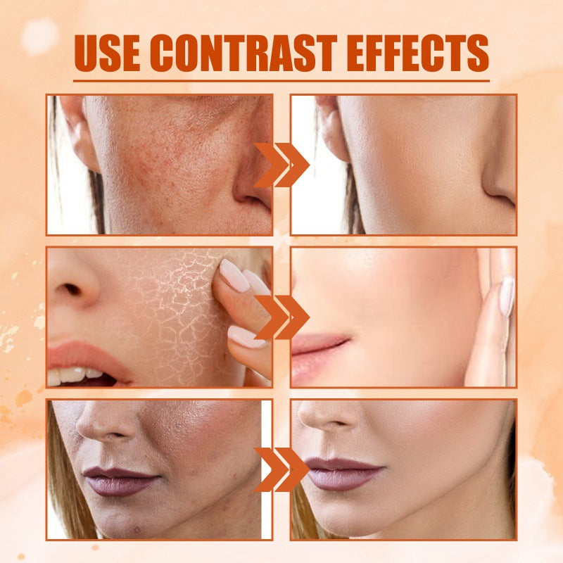 VitaminC™ | Hydrating spray fades acne spots, rejuvenates skin