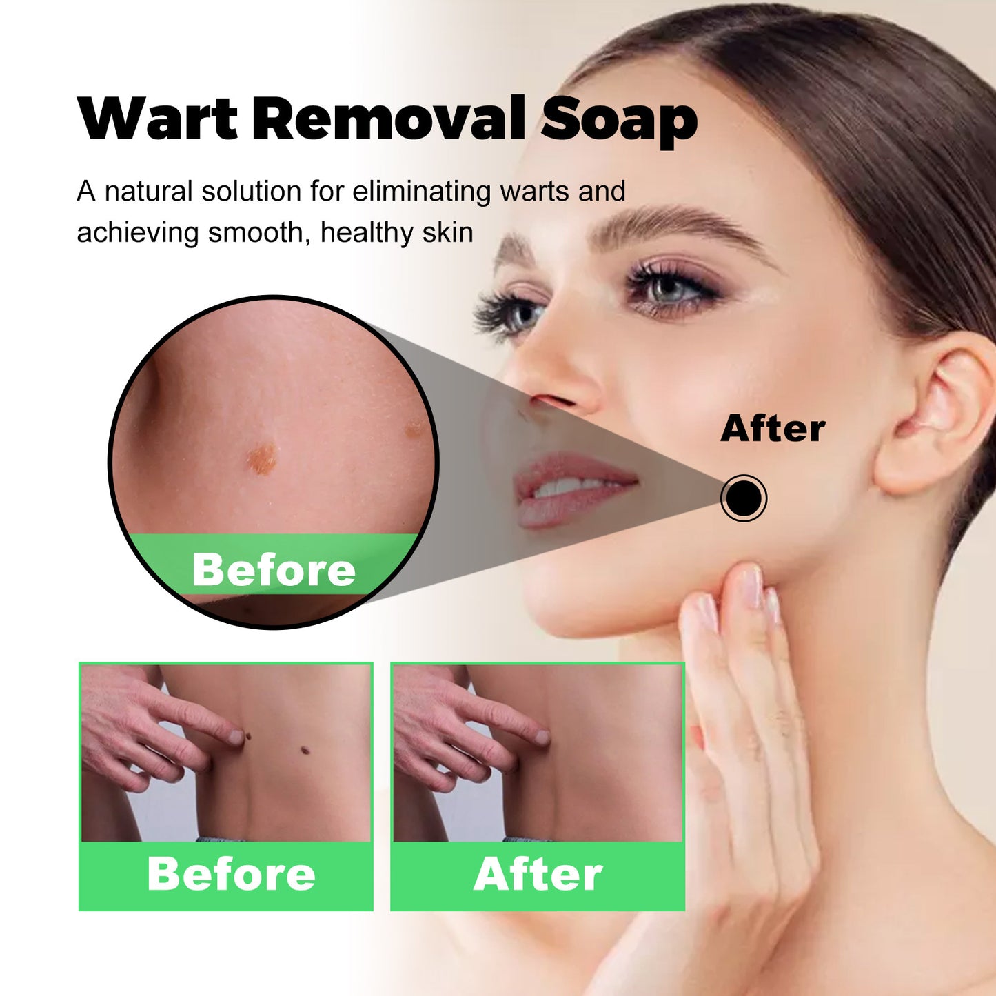 WartSoap™ | Wart removal | GE