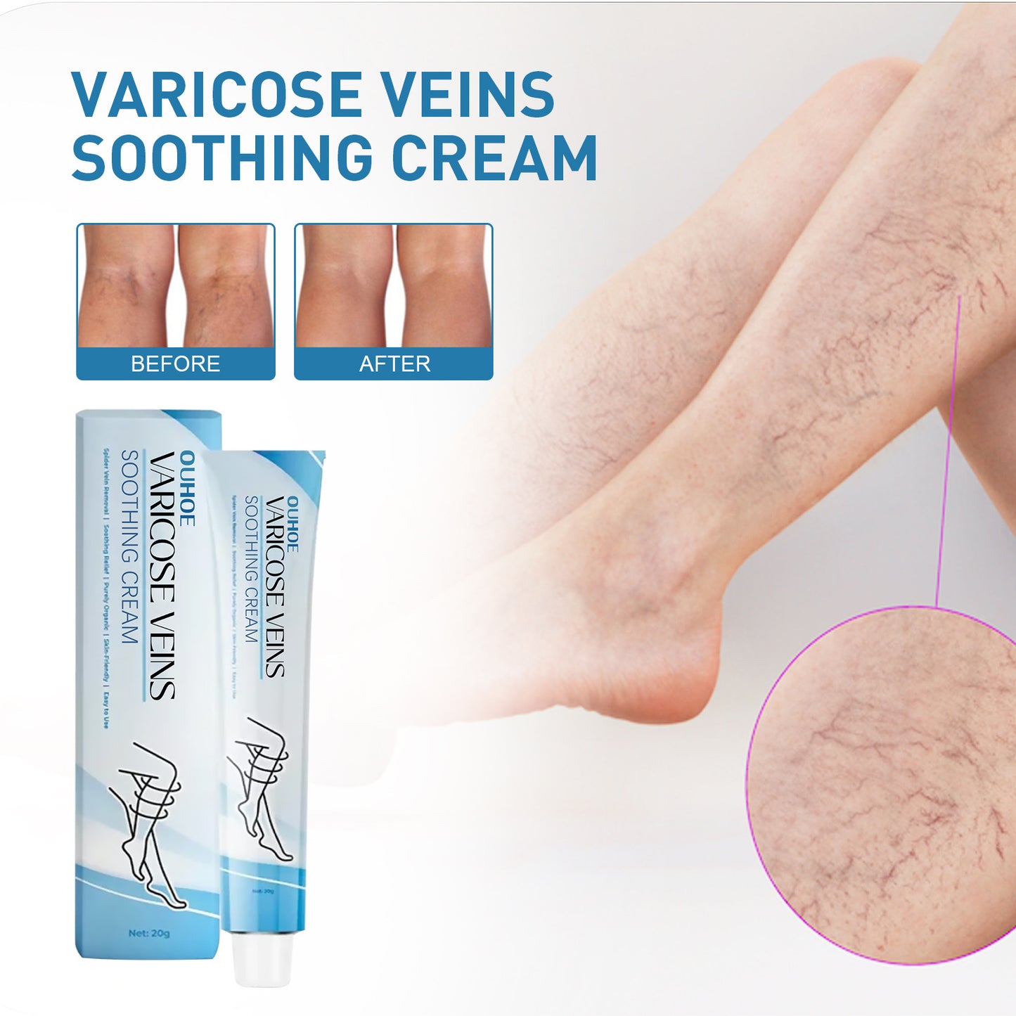 VitalVenen | Vein Repair Cream Massage