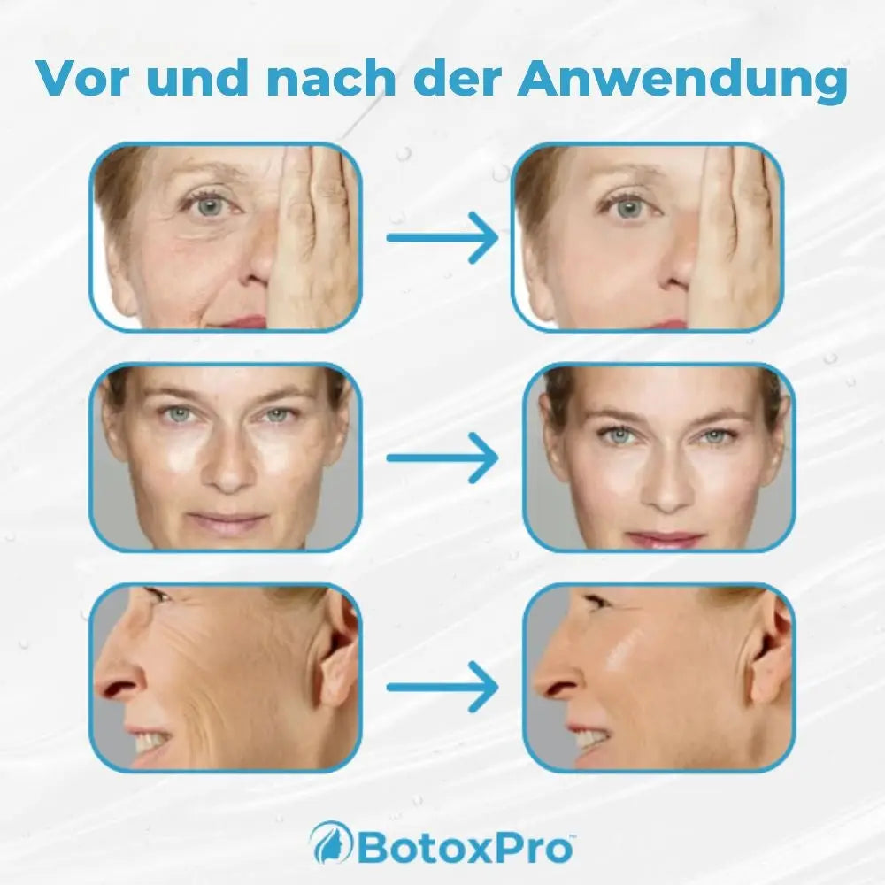 BotoxPro™ Entfernen Sie Ihre Falten und feinen Linien